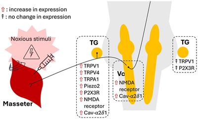 A nociceptive-nociplastic spectrum of myofascial orofacial pain: insights from neuronal ion channel studies